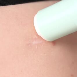 Prírodný multifunkčný SOS balzam na pokožku REGENERÁCIA & VÝŽIVA